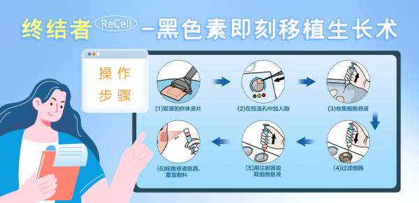 终结者操作步骤.png