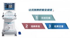 让沉默的肝脏会说话——北京大学第一医院密云医院开展“肝脏瞬时弹性检测”